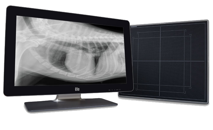 Digital X-ray system